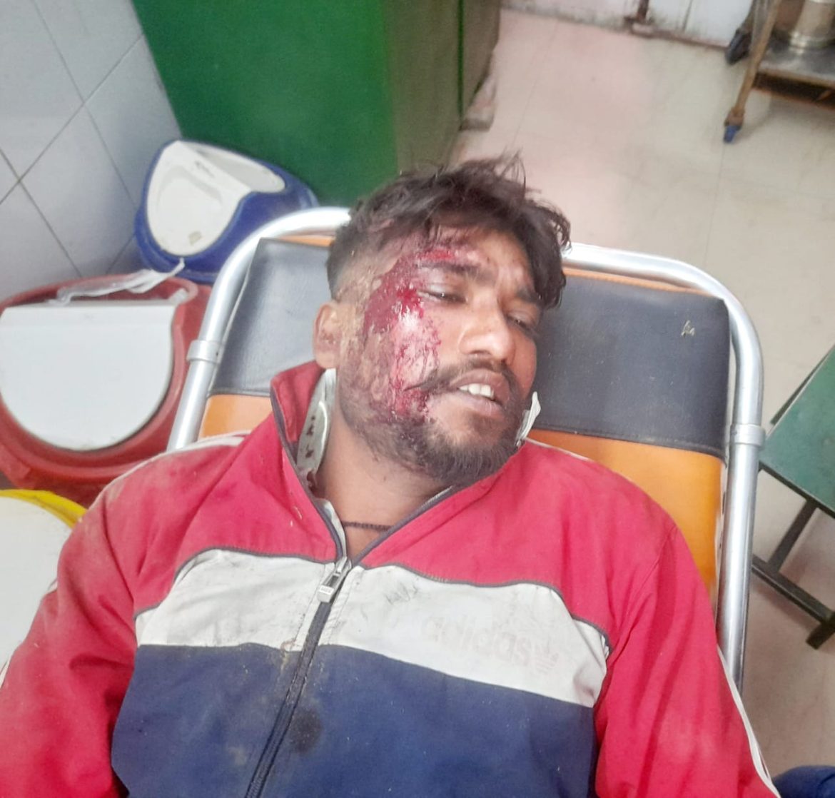 फलावदा रोड के खेडी राजवाड़े पर अज्ञात गाड़ी वाले ने मारी बाइक सवार को टक्कर गंभीर घायल :