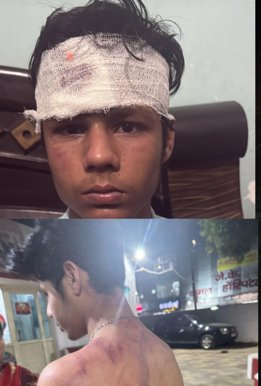 मंदिर से आ रहे नाबालिक लड़कें के साथ बाइक सवार दबंगो लड़कों ने की मारपीट :