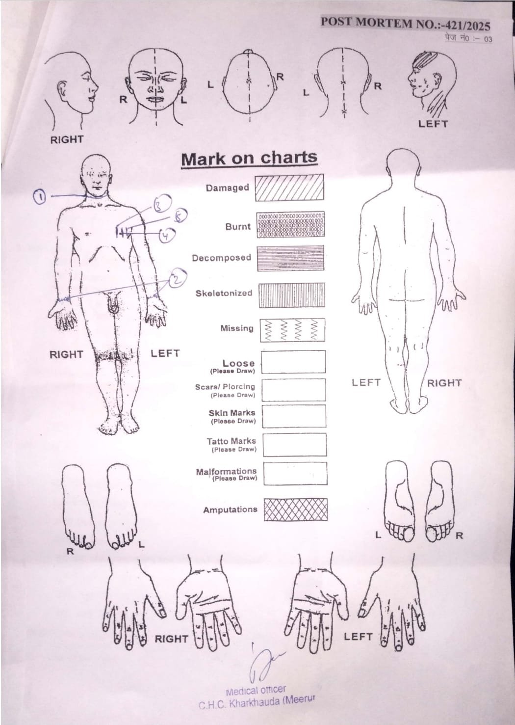 सौरभ कुमार हत्याकांड से जुड़ा बड़ा अपडेट पोस्टमार्टम रिपोर्ट में चौंकाने वाले खुलासे :