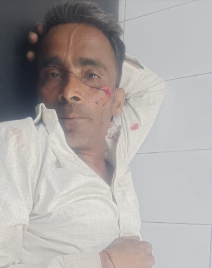 कार चालक ने बाइक में मारी टक्कर दो घायल एक की हालत गंभीर :