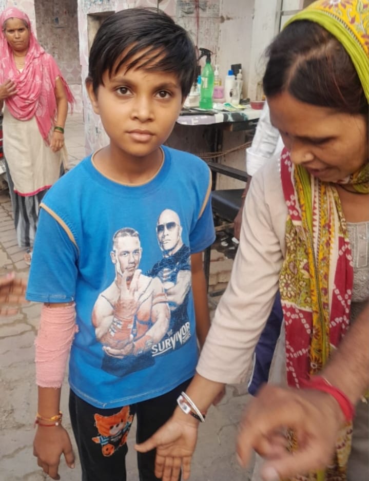 मवाना के प्राइमरी पाठशाला नंबर 3 में एक अध्यापक द्वारा छात्रा के साथ मारपीट में छात्रा का हाथ टूटा :