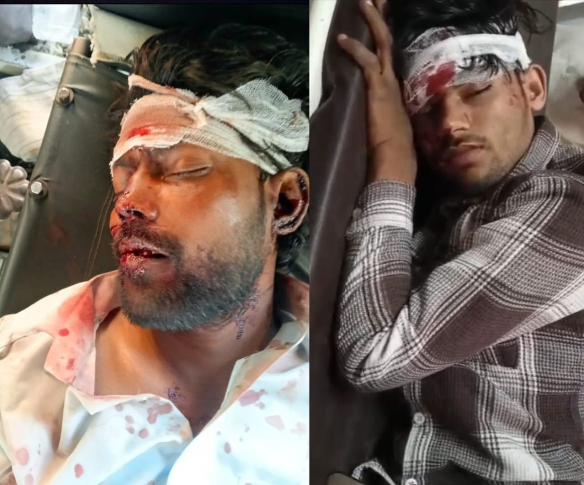 मेरठ पौड़ी मार्ग पर दो बाइकों की हुई जोरदार भिड़त दो युवक हुए गंभीर घायल :