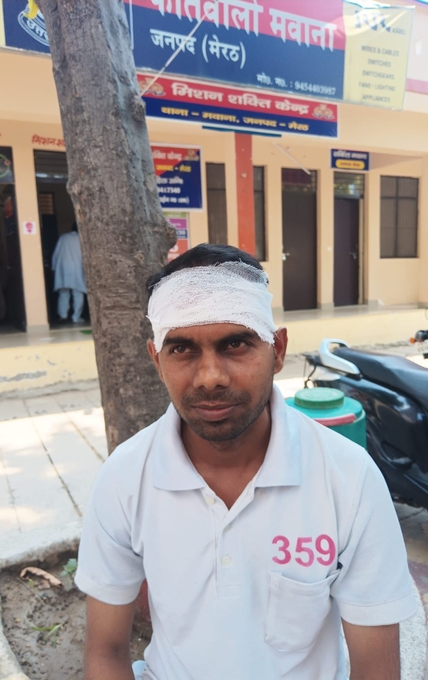 कुट्टी लेकर घर लोट रहे युवक के साथ बाइक सवार चार दबंग लड़कों ने लाठी-डंडों को बंट से मारपीट कर किया घायल :
