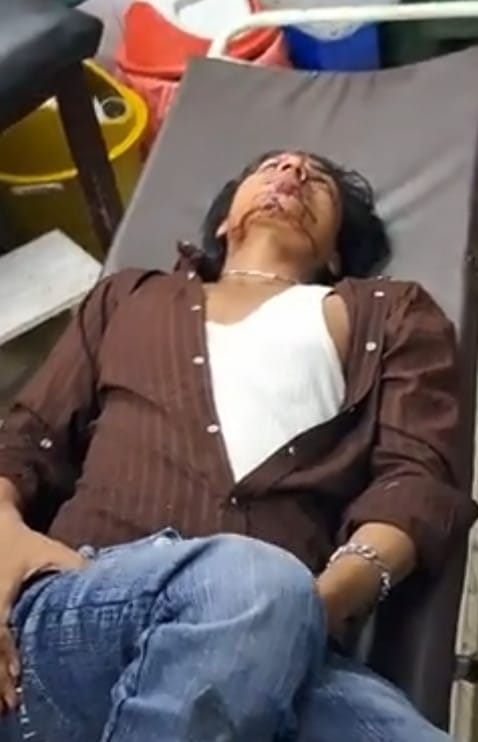 पिलोना के पास तेज रफ्तार कार ने बाइक सवार दो भाइयों को मारी टक्कर, एक की हालत गंभीर :