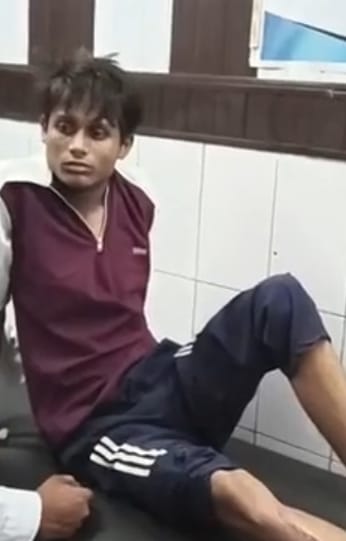 दो बाइकों की आमने-सामने भिड़ंत, नाबालिग गंभीर घायल; मेरठ रेफर :