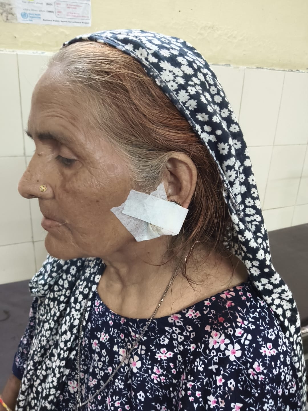 मेरठ: भावनपुर में घर के बाहर सो रही बुजुर्ग महिला से कुंडल लूटे, इलाके में दहशत :