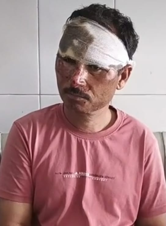 स्पीड ब्रेकर से बचने के प्रयास में बाइक फिसली, युवक गंभीर: