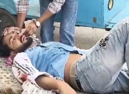 मवाना-फलावदा मार्ग पर आमने-सामने भिड़ीं दो बाइकें, दो घायल :