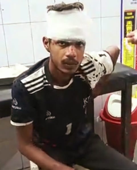 स्कूली छात्रों के बीच मारपीट में छोटे भाई को बचाने पहुंचे युवक से मारपीट, घायल :